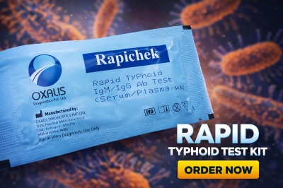 Rapichek Rapid Typhoid IgM/IgG Test Kit – Pathology Lab Diagnostic Material